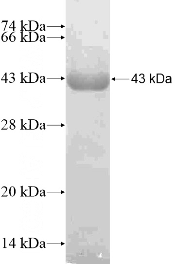 Recombinant Human CDKN1C SDS-PAGE