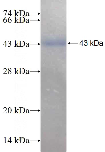 Recombinant Human BBS13 SDS-PAGE