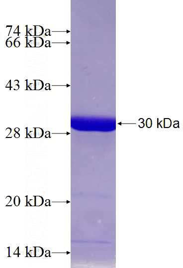 Recombinant Human FYN SDS-PAGE