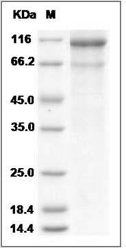 Human LOXL2 / Lysyl oxidase homolog 2 Protein (His Tag) SDS-PAGE