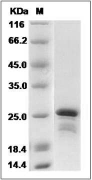Human CBFB / CBF-beta Protein (His Tag) SDS-PAGE