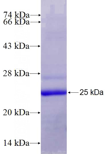 Recombinant Human MYCBP2 SDS-PAGE