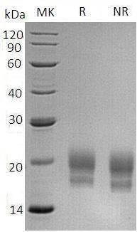 Human CEACAM3/CD66D/CGM1 (His tag) recombinant protein