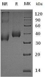 Human KLK11/PRSS20/TLSP/UNQ649/PRO1279 (His tag) recombinant protein