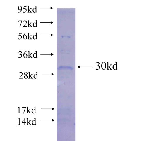 Recombinant human THAP1(Full length) SDS-PAGE