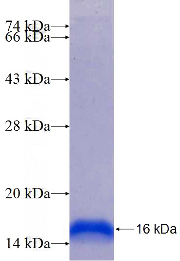 Recombinant Human HIF1AN SDS-PAGE