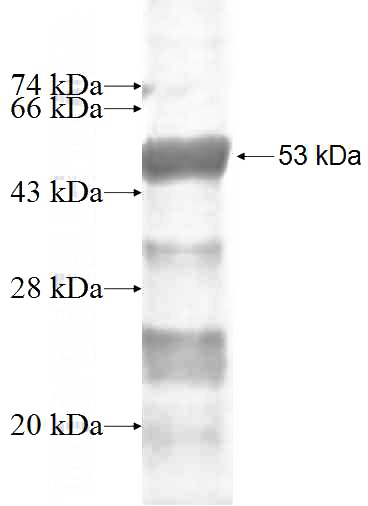 Recombinant Human APIP SDS-PAGE