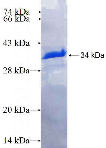 Recombinant Human AP1M1 SDS-PAGE
