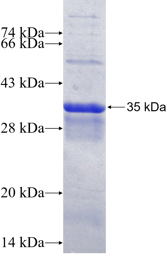 Recombinant Human BTNL2 SDS-PAGE