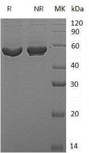 Human PIP4K2A/PIP5K2/PIP5K2A (His tag) recombinant protein