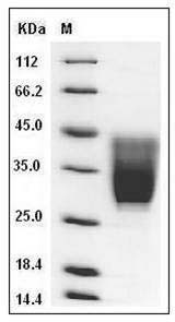 Mouse CD99L2 / MIC2L1 Protein (His Tag) SDS-PAGE
