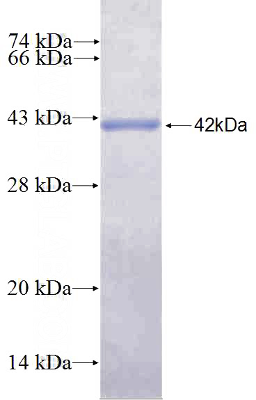 Recombinant Human CAMTA1 SDS-PAGE