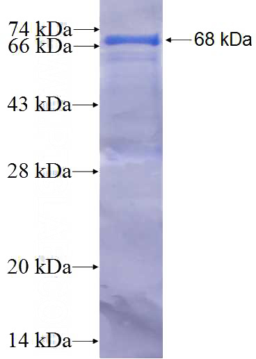 Recombinant Human ZMYND8 SDS-PAGE