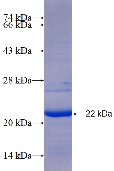 Recombinant Human FAM185A SDS-PAGE