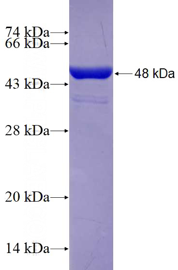 Recombinant Human KIF2C SDS-PAGE