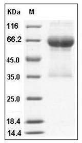 Mouse PD1 / PDCD1 Protein (His & Fc Tag) SDS-PAGE