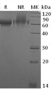 Mouse Chrdl2/Chl2 (His tag) recombinant protein