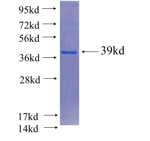 Recombinant human SCFD1 SDS-PAGE
