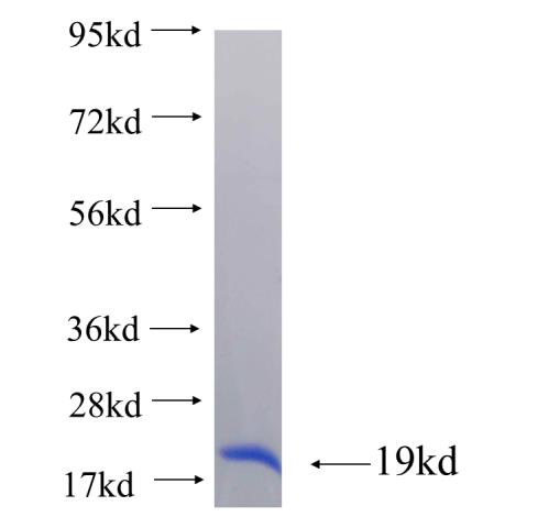 Recombinant human RHOG SDS-PAGE