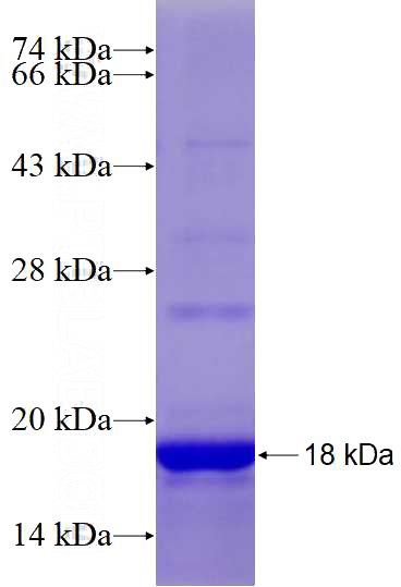Recombinant Human MYL5 SDS-PAGE