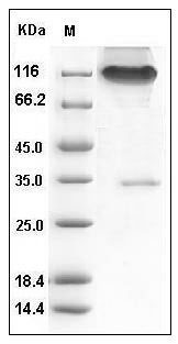 Human Neuropilin-1 / NRP1 Protein (Fc Tag) SDS-PAGE