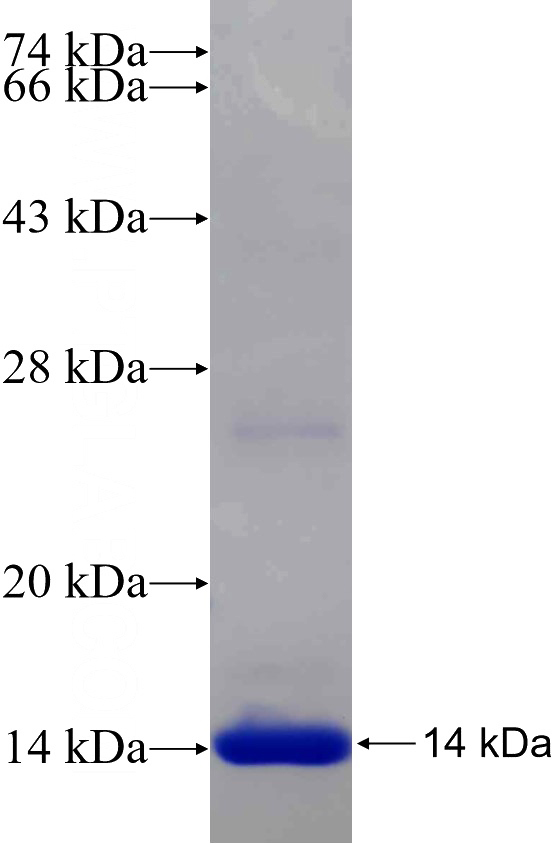Recombinant Human POTEA SDS-PAGE