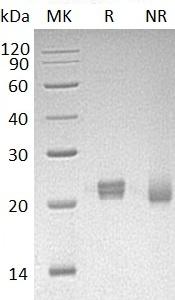Human ITPA/C20orf37/My049/OK/SW-cl.9 (His tag) recombinant protein