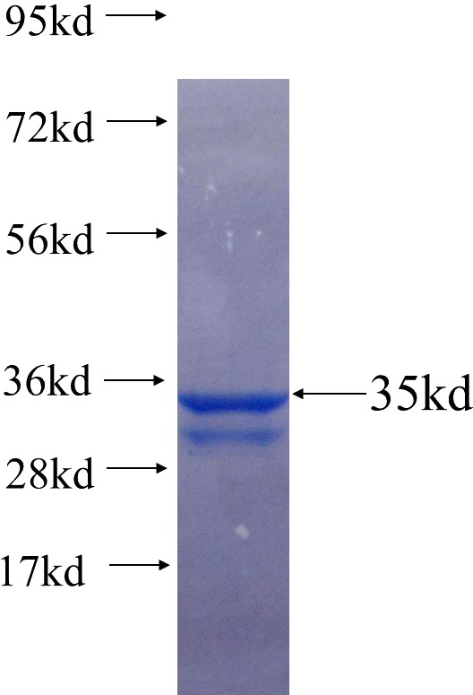 Recombinant Human ELMO1 SDS-PAGE