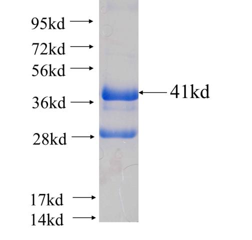 Recombinant human NDUFB6(Full length) SDS-PAGE