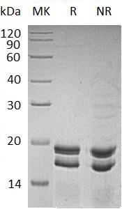 Human SUMO1/SMT3C/SMT3H3/UBL1 (His tag) recombinant protein
