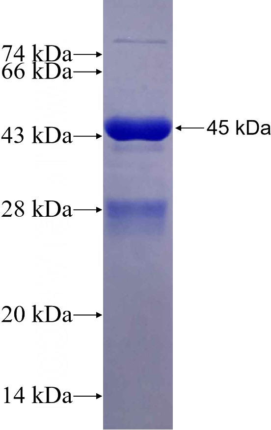 Recombinant Human FOXP2 SDS-PAGE