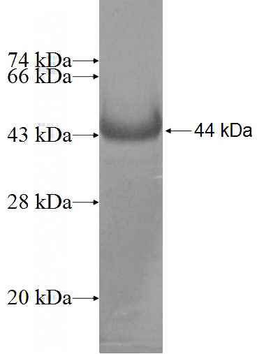 Recombinant Human TARS2 SDS-PAGE