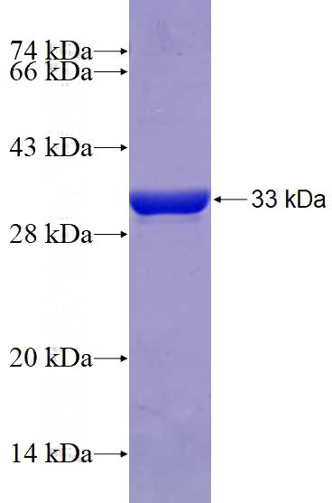 Recombinant Human PLAG1 SDS-PAGE