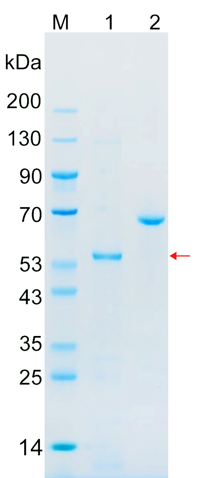 Recombinant CUL7 protein (His tag) SDS-PAGE