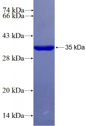 Recombinant Human PEX26 SDS-PAGE