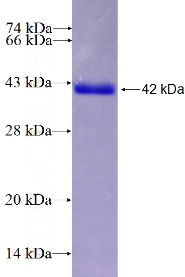 Recombinant Human ARSD SDS-PAGE
