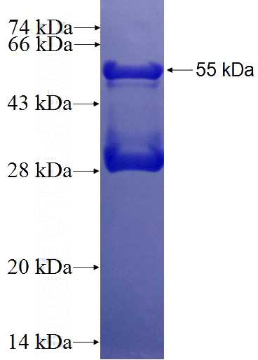 Recombinant Human GRASP65,GORASP1 SDS-PAGE
