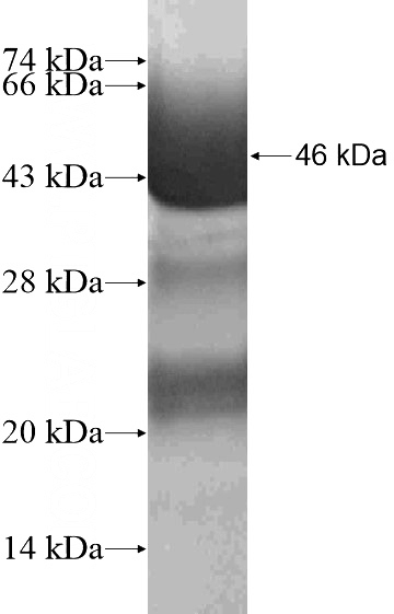 Recombinant Human HMX2 SDS-PAGE