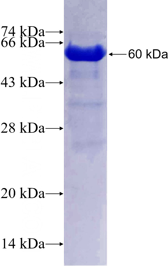 Recombinant Human EHBP1L1 SDS-PAGE