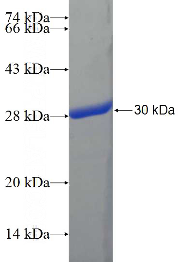 Recombinant Human KBTBD10 SDS-PAGE