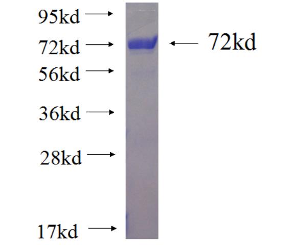 Recombinant human CTBP1 SDS-PAGE