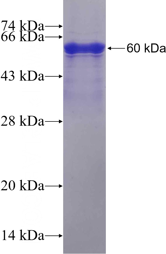 Recombinant Human NCCRP1 SDS-PAGE