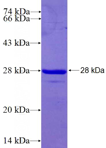 Recombinant Human BMX SDS-PAGE