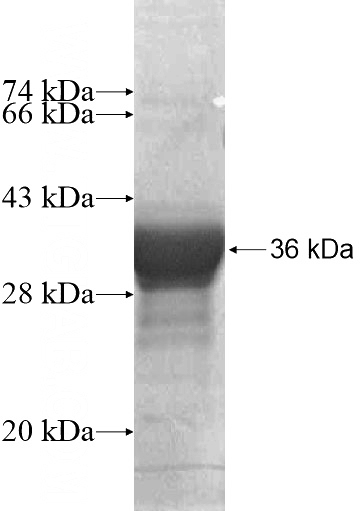 Recombinant Human GABPB2 SDS-PAGE