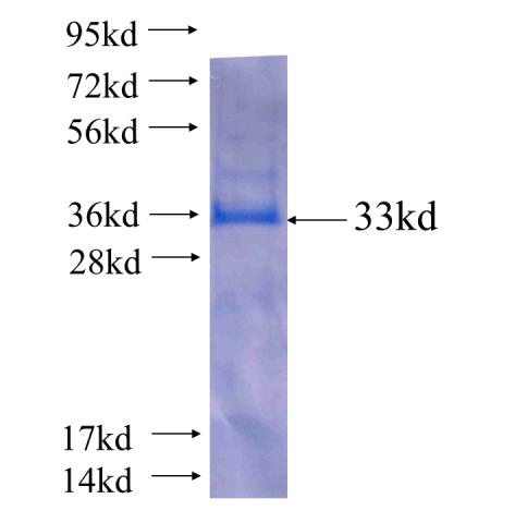 Recombinant human TP53INP1(Full length) SDS-PAGE