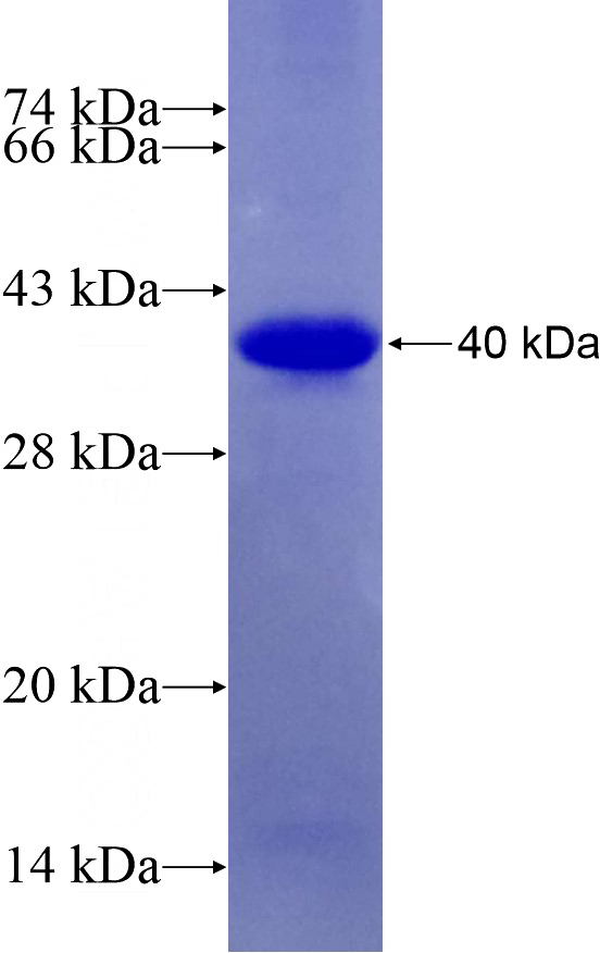 Recombinant Human CDKL5 SDS-PAGE