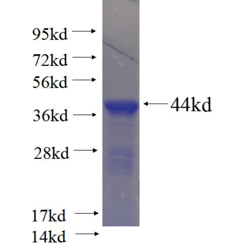 Recombinant human AGXT2L1 SDS-PAGE