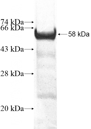 Recombinant Human ZBTB6 SDS-PAGE