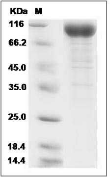 Cynomolgus IL6ST / gp130 Protein (His Tag) SDS-PAGE