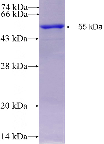 Recombinant Human CP SDS-PAGE